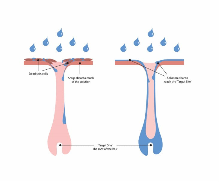 Making Minoxidil and other topically applied treatments such as ‘Regaine’ more effective