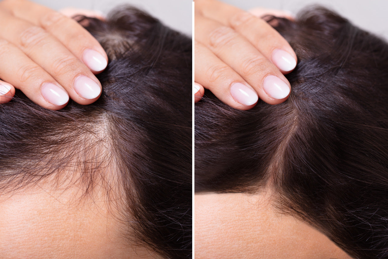 The link between hair loss and a healthy scalp