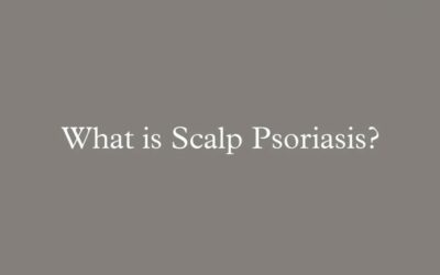 What is Scalp Psoriasis?